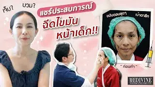 รีวิวฉีดไขมันหน้าเด็ก เจ็บจริงไหม!? แก้รูปหน้าจากเบ้าตาลึก ใต้ตาลึก ขมับตอบโทรม มาเป็นสวยหวานละมุน