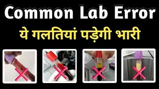 Common lab errors that can impact your test report! Be careful!