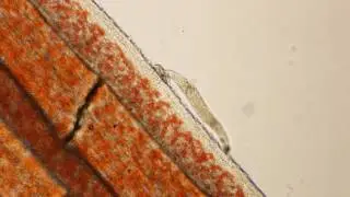 Gyrodactylus adult (skin fluke) infestation on fins of goldfish (x100) - 2