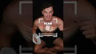 ⭕ Watch Me Reshape My Chest With the Vacuum Bell ⭕ #pectus #vacuumbell #chest