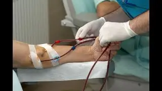 Peritoneal Dialysis to filter waste, dwell, and drain phases, sterile technique, infection risks.