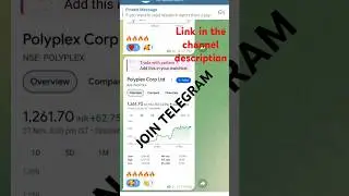 Adani stock news| stocks tips | Share market analysis| share latest news