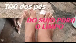 TAG DOS P&Eacute;S!!! DO SUJO PARA O LIMPO