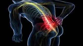Laser Spine Surgery Madison TN (615) 988 - 4831 | Sciatica, Back Pain, Spinal Stenosis