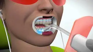 WHITEsmile POWER WHITENING