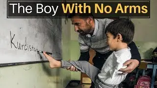 The Boy With No Arms