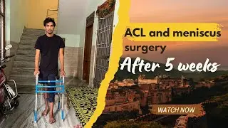 ACL And Meniscus Surgery After 5 weeks || ACL And Meniscus Repair 