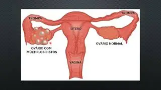 Sistema Reprodutor Feminino