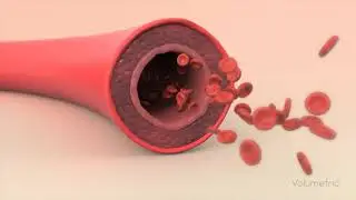 Vasodilation