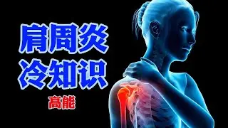 【读评论#3】你不得不知的有关肩周炎的冷知识，学会评估比盲目治疗更重要。
