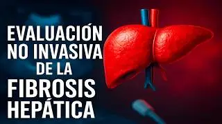 Evaluación no invasiva de la fibrosis hepática