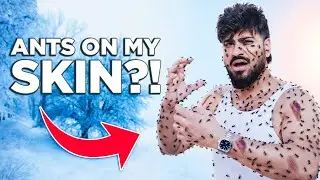 Itchy Skin in Winter? I Tried These Homemade Solutions for Instant Relief | Sahil Gera