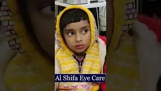 Squint Eye Treatment for Babies & Children in Pakistan Bahawalpur