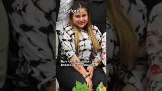 Kashaf Ansari Weight Loss Transformation🔥#shorts #exercise #youtubeshorts #weightloss