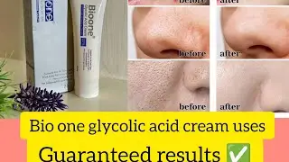 Best solution for blackheads /Bio one glycolic acid cream/ exfoliating cream