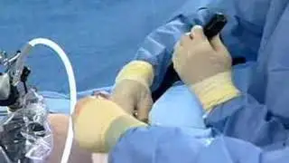 Obesity &mdash; ON-Q PainBuster 