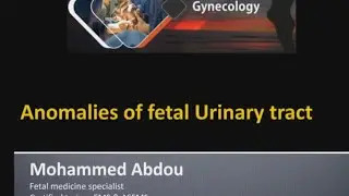 Anomalies of fetal urinary tract