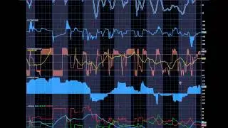 STAF Stock Chart Analysis