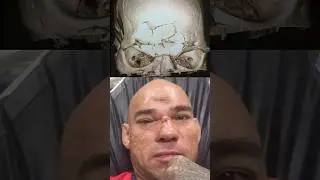 MVP vs Cyborg Santos - Career-Changing Moment #cyborg #mma #michaelvenompage