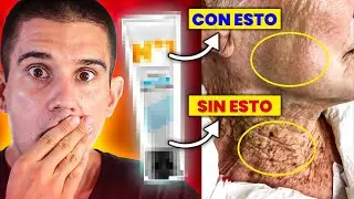 ¡ASOMBROSAS DIFERENCIAS!🤩La MEJOR CREMA ANTIARRUGAS ES ESTA