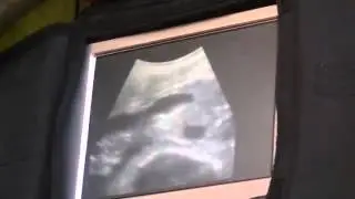 Scanning dairy cows in Australia