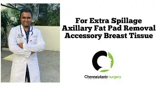 Axillary Fat Pad Removal | Accessory Breast Tissue - Dr.Karthik.R