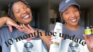 10 month loc update🌱| dandruff, new products, & tips