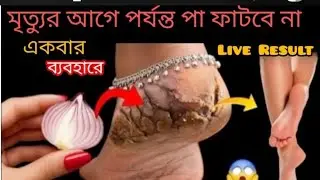 এক রাতে পা ফাটা থেকে মুক্তি পাওয়ার ঘরোয়া পদ্ধতি/cracked heels treatment/kitchen tips & hack