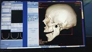 CT SCAN GE MACHINE CT 3D FACE