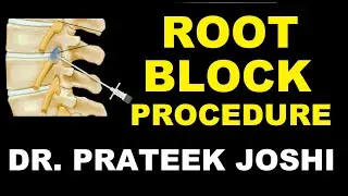 Selective Nerve Root Block Procedure | Sciatica Injection Treatment | Dr. Prateek Joshi