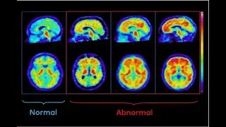 Tracers in Ionizing Radiation | Biomedical Image Processing | SNS Institutions