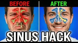 Unblock Your Sinuses Instantly: The Ancient 'Cheekbone' Technique (Works in 60 Seconds)&rdquo;