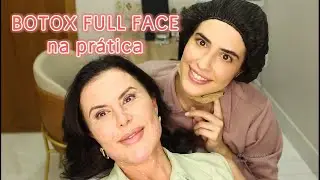 BOTOX FULL FACE: PRÁTICA COM EXPLICAÇÃO NO ROSTO E PESCOÇO (do jeito que vai ser o FULL FACE quinta)