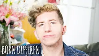 My Face Is Paralysed So I Can't Smile | BORN DIFFERENT