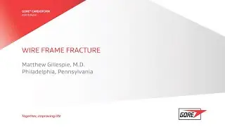 Dr. Gillespie Wire Frame Fracture discussion - PICS 2024