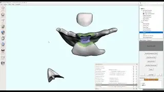 D3Lab x64  -  Flipper (Temporary Transitional Partial) Fabrication in Meshmixer
