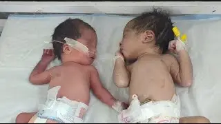 Fazl Neonatologist | Neonatal Care & NICU Education