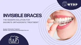 Invisible Braces: The Modern Solution for Discrete Orthodontic Treatment
