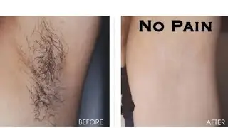 NO SHAVING 😳NO WAXING. REMOVE BODY HAIR PERMANENTLY AND PAINLESSLY WITH ONLY 3 INGREDIENTS.