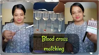 Blood cross matching//compatibility testing//recipient and donors blood sample.