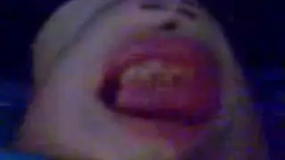 Shmoos chin