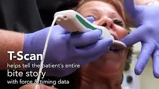 What is T-Scan? In 30 seconds