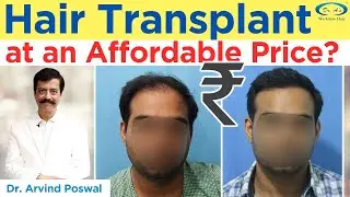 🤷‍♂️How to Choose Best Hair Transplant Surgeon? ✅Hair Transplant at an Affordable Price? #delhi