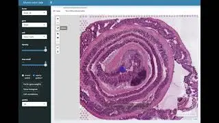 Spatial transcriptomics of the healing colon - explorer