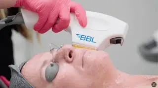 BBL BroadBand Light SCITON - PREMIER OKC