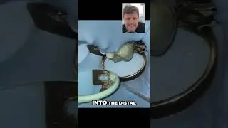 Dentist's Secret  How to Manually Place the Apical File!