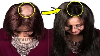 Only 2 powerful ingredients,🌿 and your hair will grow 3 times extremely faster
