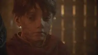 A Plague Tale: Innocence | Hugo succombe &agrave; la Macula
