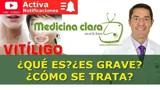 Vitiligo, manchas blancas en la piel ¿por qué se produce, cómo se trata? | Medicina Clara