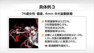 【U-info】どのように治療法を決める